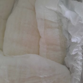 Molfix 4 Numaralı Bebek Bezinde Emici Jel Patlaması Ve Genital Bölgeye Saçılması