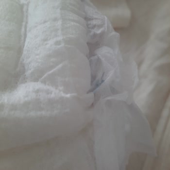 Molfix 4 Numaralı Bebek Bezinde Emici Jel Patlaması Ve Genital Bölgeye Saçılması