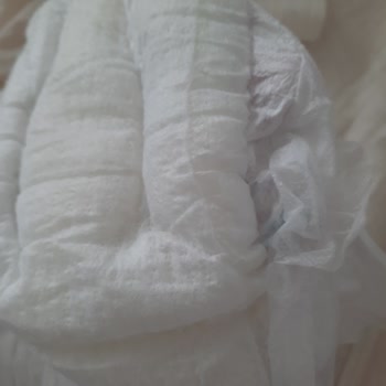 Molfix 4 Numaralı Bebek Bezinde Emici Jel Patlaması Ve Genital Bölgeye Saçılması
