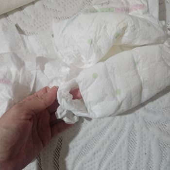 Sleepy Natural 6 Numaralı Bebek Bezinde Yırtılma Ve Dayanıksızlık