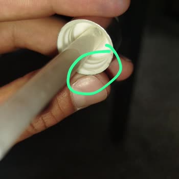 Saç Mezoterapisi Hijyen İhlali Ve Söz Verilen Seansların Gerçekleşmemesi Nedeniyle İade Talebi