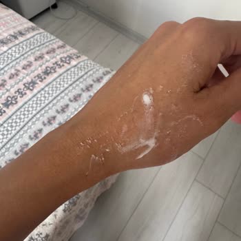 Nivea Pearl & Beauty Stick Deodorantların Pütürlü Yapısı Nedeniyle Kullanılamaması Ve İade Talebi