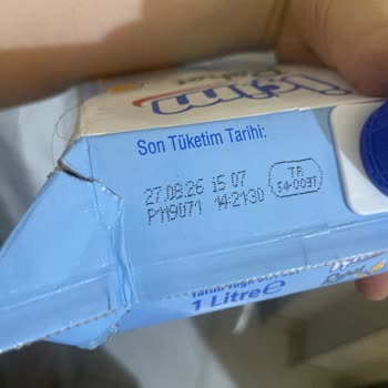 İçim Rahat Sütünde Saç Bulunması Ve Hijyen Sorunu