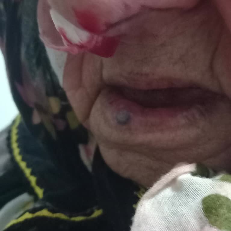 Samsun Gazi Devlet Hastanesi Acil Serviste Hayati Riskli Hastayı Gözlem Süzülmeden Taburcu Etmesi