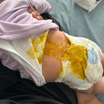 Molfix Bebek Bezinde Sızdırma Ve Taşma Sorunu