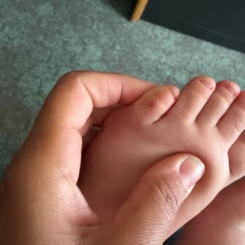 Sert Dikişli Sandalet Çocuğumun Ayağını Yaraladı