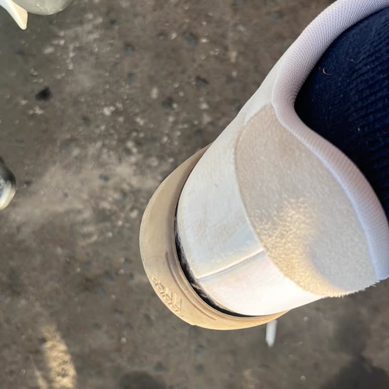 Adidas Ayakkabısının Taban Açılmasına Karşı Garanti Sorumluluğu Tartışması