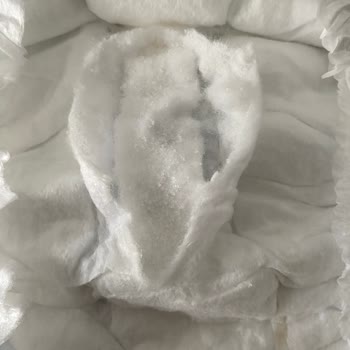 Molfix Bebek Bezinde Sertleşen İç Kısım Çocukta Pişik Ve Sızıntıya Neden Oluyor