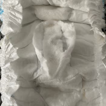 Molfix Bebek Bezinde Sertleşen İç Kısım Çocukta Pişik Ve Sızıntıya Neden Oluyor
