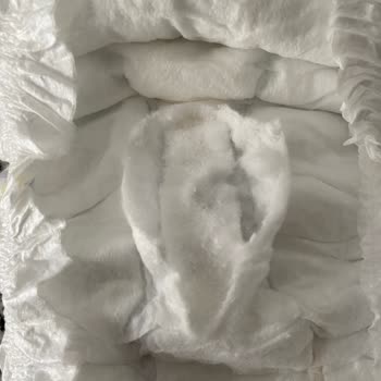 Molfix Bebek Bezinde Sertleşen İç Kısım Çocukta Pişik Ve Sızıntıya Neden Oluyor