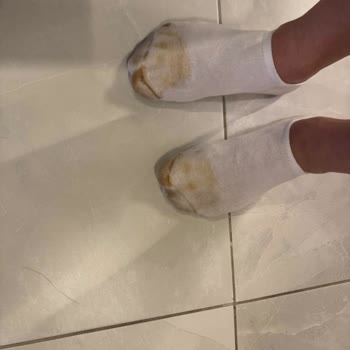 Deriden Sneaker’da Boya Sızdırması Ve Değişim Reddi