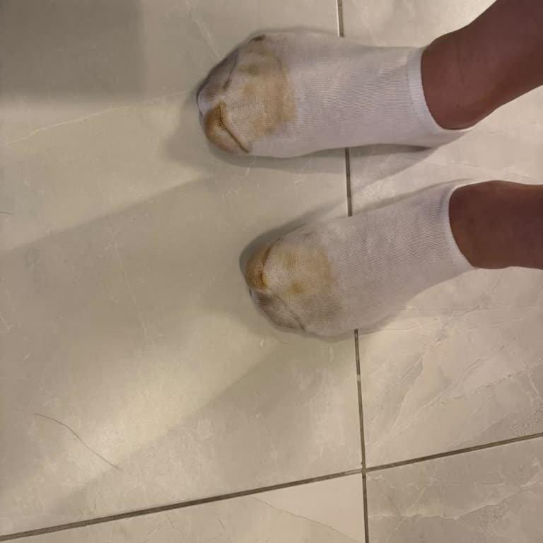 Deriden Sneaker’da Boya Sızdırması Ve Değişim Reddi