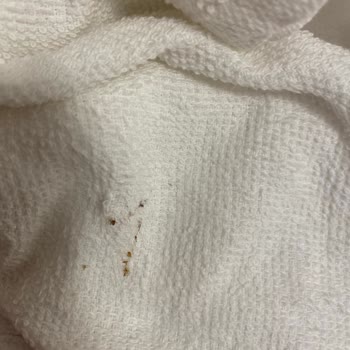 Tahtakurusu Sorunu Nedeniyle 3 Gün Boyunca Aşırı Konaklama Ücreti Ve Eşya Kayıpları