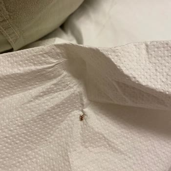 Tahtakurusu Sorunu Nedeniyle 3 Gün Boyunca Aşırı Konaklama Ücreti Ve Eşya Kayıpları