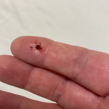 Tahtakurusu Sorunu Nedeniyle 3 Gün Boyunca Aşırı Konaklama Ücreti Ve Eşya Kayıpları