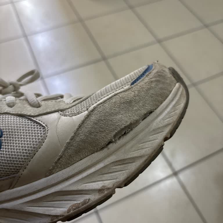 Skechers Ayakkabım Kısa Sürede Yanlardan Açıldı