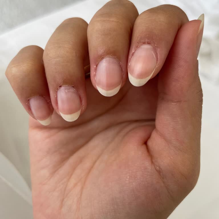 Nur Karahan Beauty Etlerim Tamamen Kanadı Ve Ciddi Şekilde Tahriş Oldu