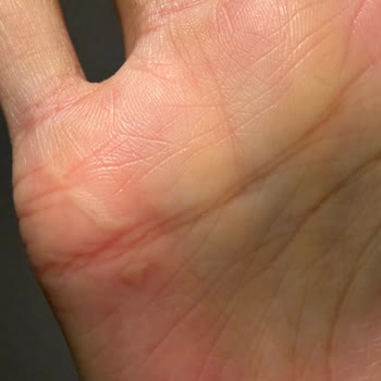 Remington Saç Düzleştiricide Patlama Ve Yanık Tehlikesi