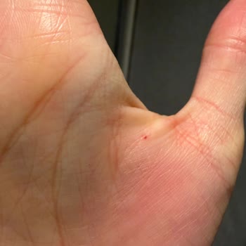Remington Saç Düzleştiricide Patlama Ve Yanık Tehlikesi