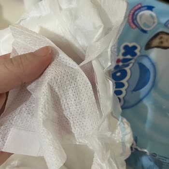 Molfix 6 Numaralı Bebek Bezinde Yırtık Ve Sızıntı Problemi