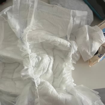 Molfix 6 Numaralı Bebek Bezinde Yırtık Ve Sızıntı Problemi
