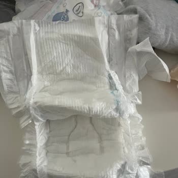 Molfix 6 Numaralı Bebek Bezinde Yırtık Ve Sızıntı Problemi