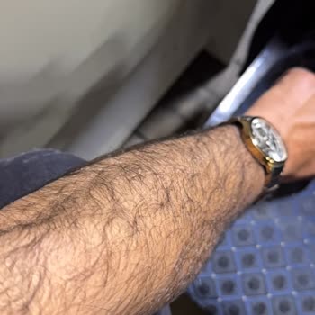 Eva Vip Güzellik Merkezinde Lazer Epilasyon Garanti Kırıldı Ve Tehdit Edildi