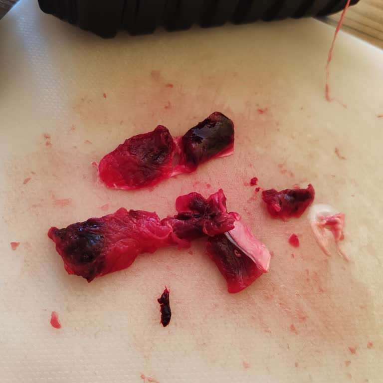 Kan Pıhtısı Ve Siyah Et Parçaları Sağlık Riskine Yol Açıyor