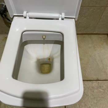 Aydın Elitium Otelinde Kötü Hijyen Ve Zehirli Yemekler Nedeniyle Tek Gece Konaklama
