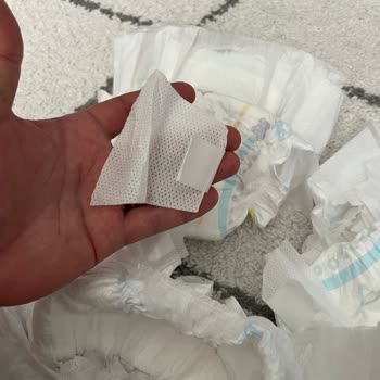 Molfix Bebek Bezlerinde Yapıştırma Kulaklarının Kopması