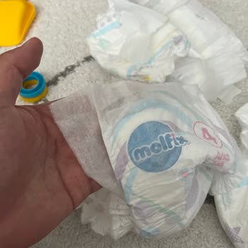 Molfix Bebek Bezlerinde Yapıştırma Kulaklarının Kopması