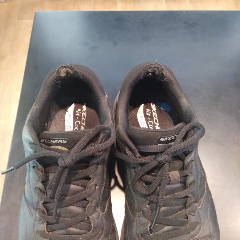 Skechers Erkek Ayakkabısının Kısa Sürede Topuk Yırtılması Ve Üretim Hatası İddiası