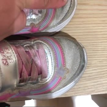 Üç Aylık Skechers Ayakkabı Değişimi Kabul Etmedi