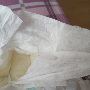 Molfix 5 Numaralı Bezlerde Üst Katman Ayrılması Ve Hijyen Endişesi