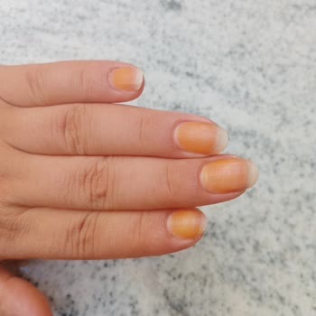 Flormar Ojesi Tırnaklarımı Turuncuya Dönüştürdü Ve Çıkarılamıyor