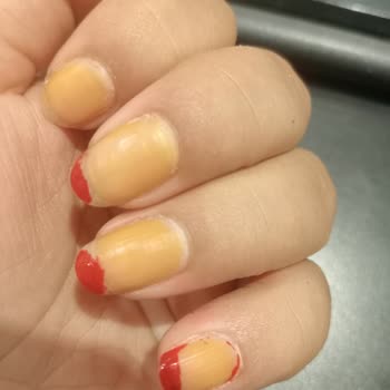 Flormar Ojesi Tırnaklarımı Turuncuya Dönüştürdü Ve Çıkarılamıyor