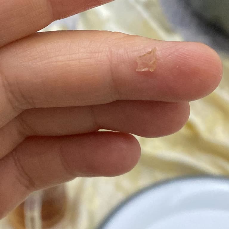 Bademli Çikolatada Cam Parçası: Sağlık Riski Ve Güven Sarsıntısı