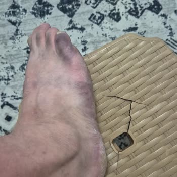 Ayaklarım Boyandı: Kalitesiz Sandalet Şikayeti