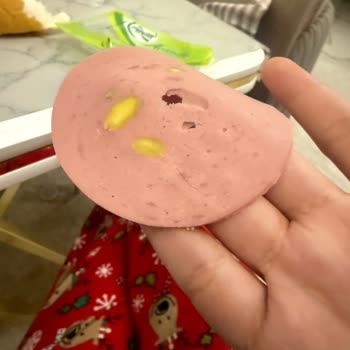 Salamda Kıl Görüldü, Hijyen Şikayeti