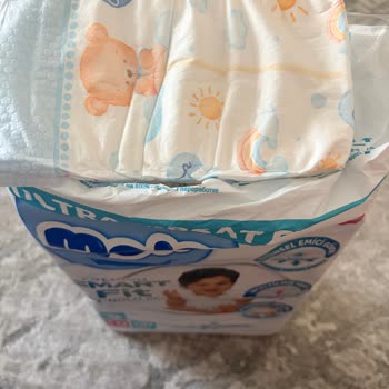 Molfix Bebek Bezinde Keskin Plastik Koku Ve Cilt Tahrişi
