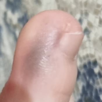 Sağ Ayağımı Yaran Nike Ayakkabının İade Talebi Reddedildi