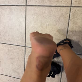 Camper Sandaletlerinde Ayak Boyası Sorunu Sağlık Riskine Dönüştü