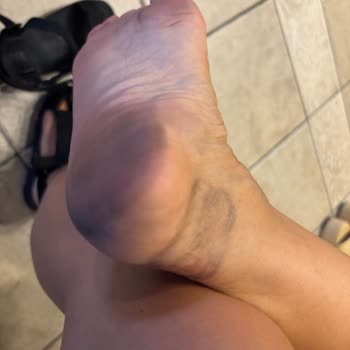 Camper Sandaletlerinde Ayak Boyası Sorunu Sağlık Riskine Dönüştü