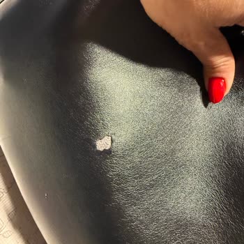Beymen Çantadaki Ayipları Görmezden Gelerek Değişim Talebini Reddetti