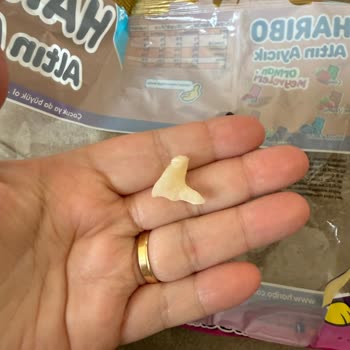 Haribo Jelibon Paketi İçinde Yabancı Cisim Bulundu, Şikayetime Cevap Gelmedi