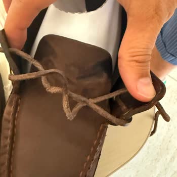 Uzun Süreli Bekleme Sonrası Kalitesiz Temizlik Ve Dikiş Onarımı