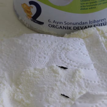 Hipp Organik Combiotic Mamasında Yabancı Madde Ve Hijyen Sorunu