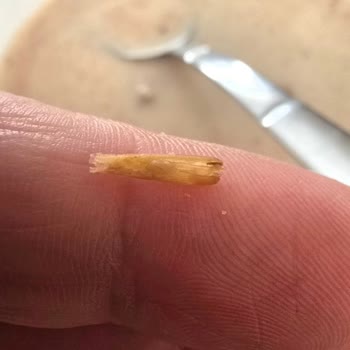 Kellogg's Granola’da Yabancı Ot Sapı Görüldü Güvenim Sarsıldı
