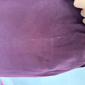 Defolu Elbise İçin Ücretsiz Değişim Ve İade Talebi
