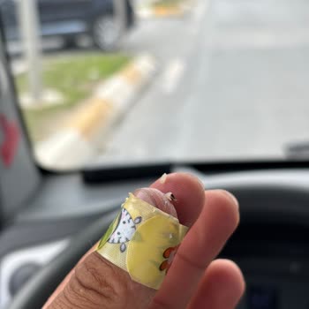 A101 Saraçlar Şubesinde Vişne Reçelinde Çekirdek Nedeniyle Diş Kırılması Ve Tedavi Masrafı Talebi